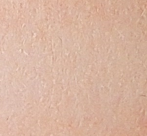 139 (Flesh)